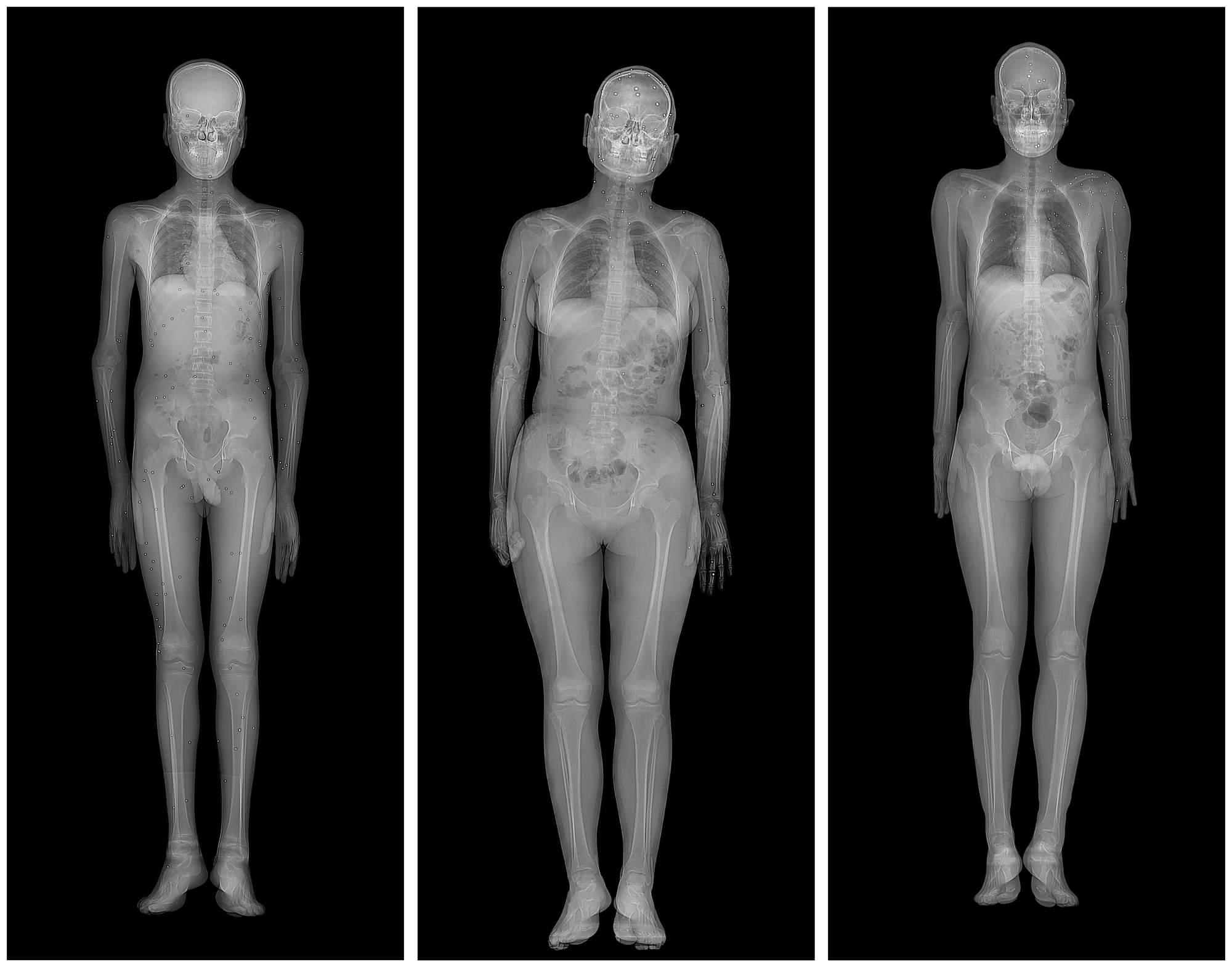 /portfolio_submission/3 .X-Ray Portraits of Pellet Victims.jpg